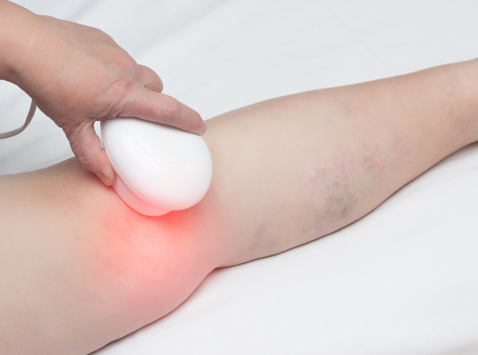 Rešitev, ko je artroza kolena neznosna