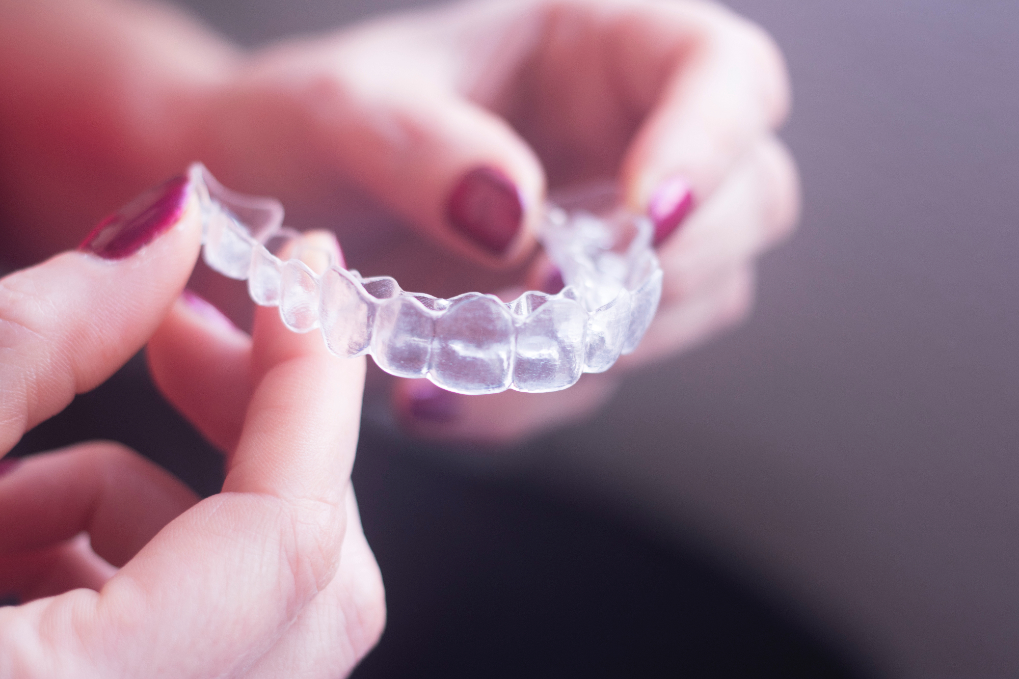 Prijateljici je Invisalign pomagal pridobiti nazaj samozavest